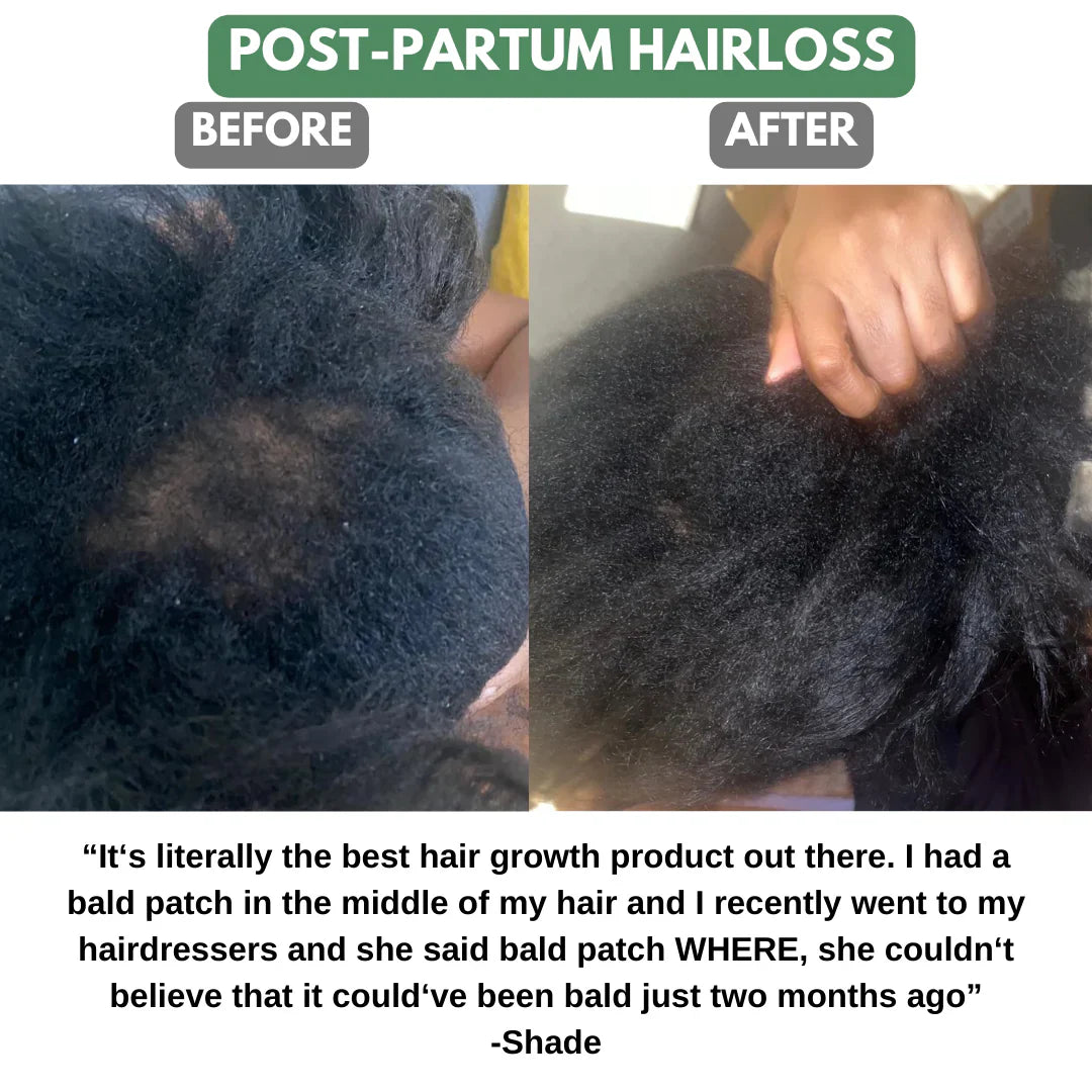 Batana Natural Hair Oil