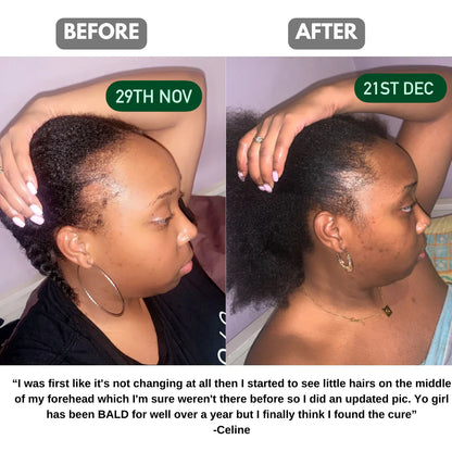 Batana Natural Hair Oil